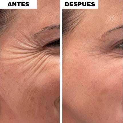 Bálsamo de Colágeno ANTIARRUGAS (1 + 1 GRATIS)