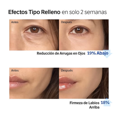 Sérum Voluminizador de Colágeno (1+1 GRATIS)