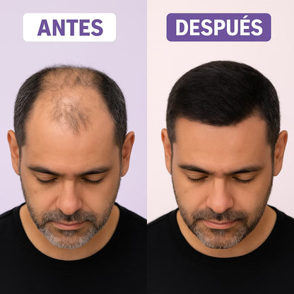 RELLENO CAPILAR INSTANTANEO.