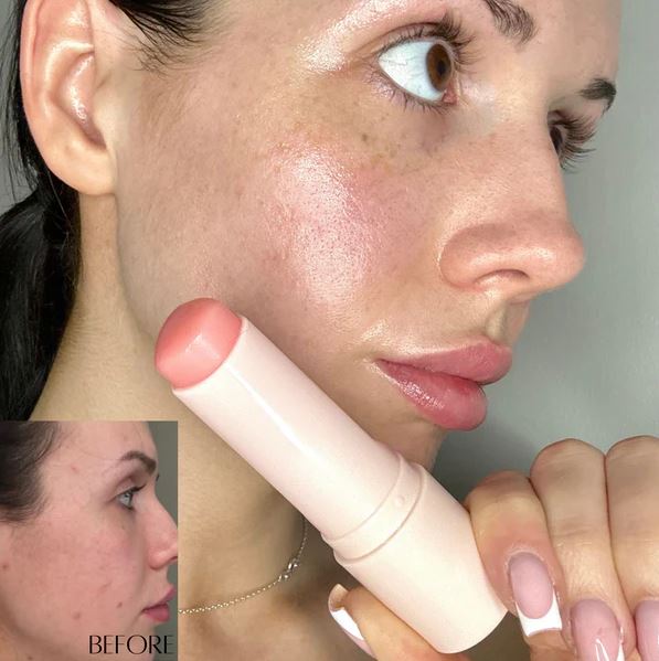 Bálsamo de Colágeno ANTIARRUGAS (1 + 1 GRATIS)
